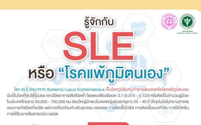 รพ.ราชวิถี ชวนรู้จักโรค SLE หรือโรคแพ้ภูมิตนเอง