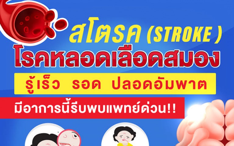 หยุดการเป็นหนึ่งในผู้ป่วยโรคหลอดเลือดสมอง ต้นเหตุ อัมพฤกษ์ - อัมพาต “รู้เร็ว รอด ปลอดอัมพาต”