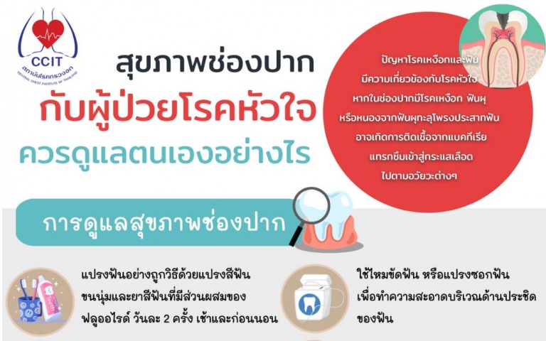 ปัญหาสุขภาพช่องปาก ที่ผู้ป่วยโรคหัวใจต้องระวัง