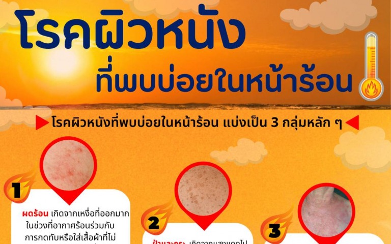 โรคผิวหนังที่พบบ่อยในหน้าร้อน